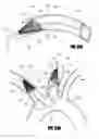 Fig. 41 - Method of accessing the left common carotid artery