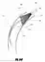 Fig. 42 - Method of accessing the left common carotid artery