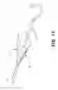 Fig. 07 - Aortic embolic protection device