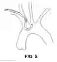 Fig. 10 - Aortic embolic protection device