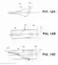 Fig. 23 - Aortic embolic protection device
