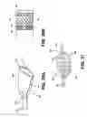 Fig. 24 - Aortic embolic protection device