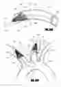 Fig. 41 - Aortic embolic protection device