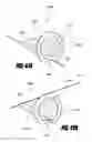 Fig. 53 - Aortic embolic protection device