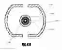 Fig. 59 - Aortic embolic protection device