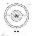 Fig. 63 - Aortic embolic protection device