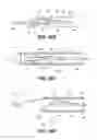 Fig. 33 - Deflectable intravascular filter
