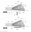 Fig. 47 - Deflectable intravascular filter