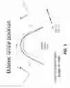 Fig. 06 - External nasal dilator