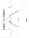 Fig. 07 - External nasal dilator