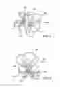 Fig. 03 - Left atrial appendage occlusive devices