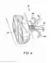Fig. 08 - Left atrial appendage occlusive devices