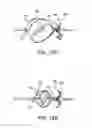 Fig. 09 - Left atrial appendage occlusive devices