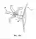 Fig. 26 - Left atrial appendage occlusive devices