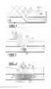 Fig. 02 - Apparatus and method for sealing a vessel puncture opening