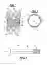 Fig. 04 - Apparatus and method for sealing a vessel puncture opening