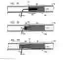 Fig. 07 - Apparatus for closure of a lumen and methods of using the same