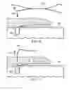 Fig. 05 - Suture