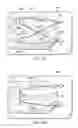 Fig. 08 - Suture
