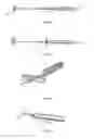 Fig. 10 - Implanted medical device useful for cosmetic surgery
