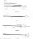 Fig. 15 - Implanted medical device useful for cosmetic surgery