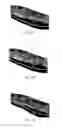 Fig. 20 - Implanted medical device useful for cosmetic surgery