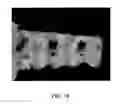 Fig. 26 - Implanted medical device useful for cosmetic surgery