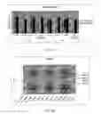 Fig. 28 - Implanted medical device useful for cosmetic surgery