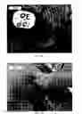 Fig. 35 - Implanted medical device useful for cosmetic surgery