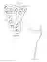 Fig. 04 - System for treating bone fractures