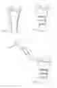 Fig. 05 - System for treating bone fractures
