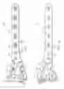 Fig. 11 - System for treating bone fractures