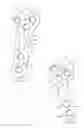 Fig. 13 - System for treating bone fractures