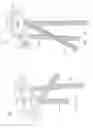 Fig. 16 - System for treating bone fractures