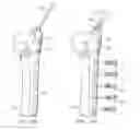 Fig. 22 - System for treating bone fractures