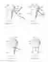 Fig. 28 - System for treating bone fractures