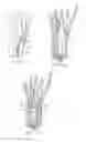 Fig. 34 - System for treating bone fractures