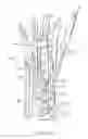 Fig. 42 - System for treating bone fractures