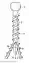 Fig. 01 - Expansion screw bone tamp