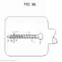 Fig. 06 - Expansion screw bone tamp