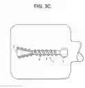 Fig. 07 - Expansion screw bone tamp