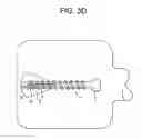 Fig. 08 - Expansion screw bone tamp