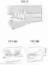 Fig. 13 - Expansion screw bone tamp