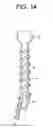 Fig. 20 - Expansion screw bone tamp