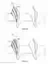 Fig. 11 - Bone screw and method for manufacturing the same
