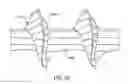 Fig. 17 - Bone screw and method for manufacturing the same