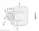 Fig. 11 - Spinal stabilization installation instrumentation and methods