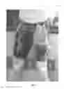Fig. 03 - Therapeutic Garment