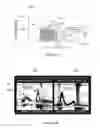 Fig. 07 - METHODS AND APPARATUS FOR OPTIMIZING CARDIAC OUTPUT, PREVENTING BACKWARD HEART FAILURE, AND MINIMIZING DIASTOLIC MYOCARDIAL WALL STRESS BY CONTROLLING LEFT VENTRICULAR FILLING