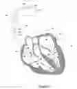 Fig. 05 - Retrograde atrial sensing for identifying sub-threshold atrial pacing